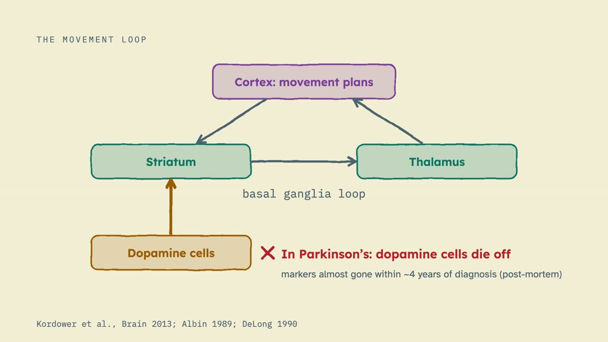 From the video: THE MOVEMENT LOOP, Cortex: movement plans, Striatum, Thalamus, basal ganglia loop, Dopamine cells, In Parkinson’s: dopamine cells die off, markers almost gone within ~4 years of diagnosis (post-mortem), Kordower et al., Brain 2013; Albin 1989; DeLong 1990