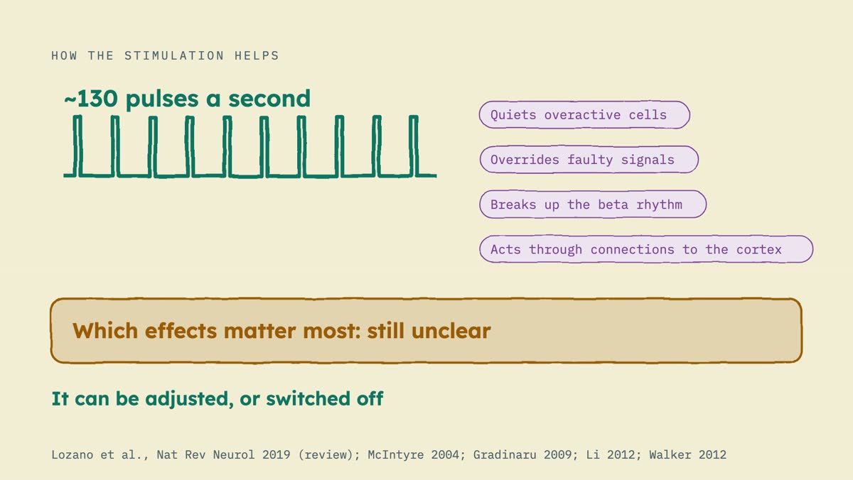 From the video: HOW THE STIMULATION HELPS, ~130 pulses a second, Quiets overactive cells, Overrides faulty signals, Breaks up the beta rhythm, Acts through connections to the cortex, Which effects matter most: still unclear, It can be adjusted, or switched off, Lozano et al., Nat Rev Neurol 2019 (review); McIntyre 2004