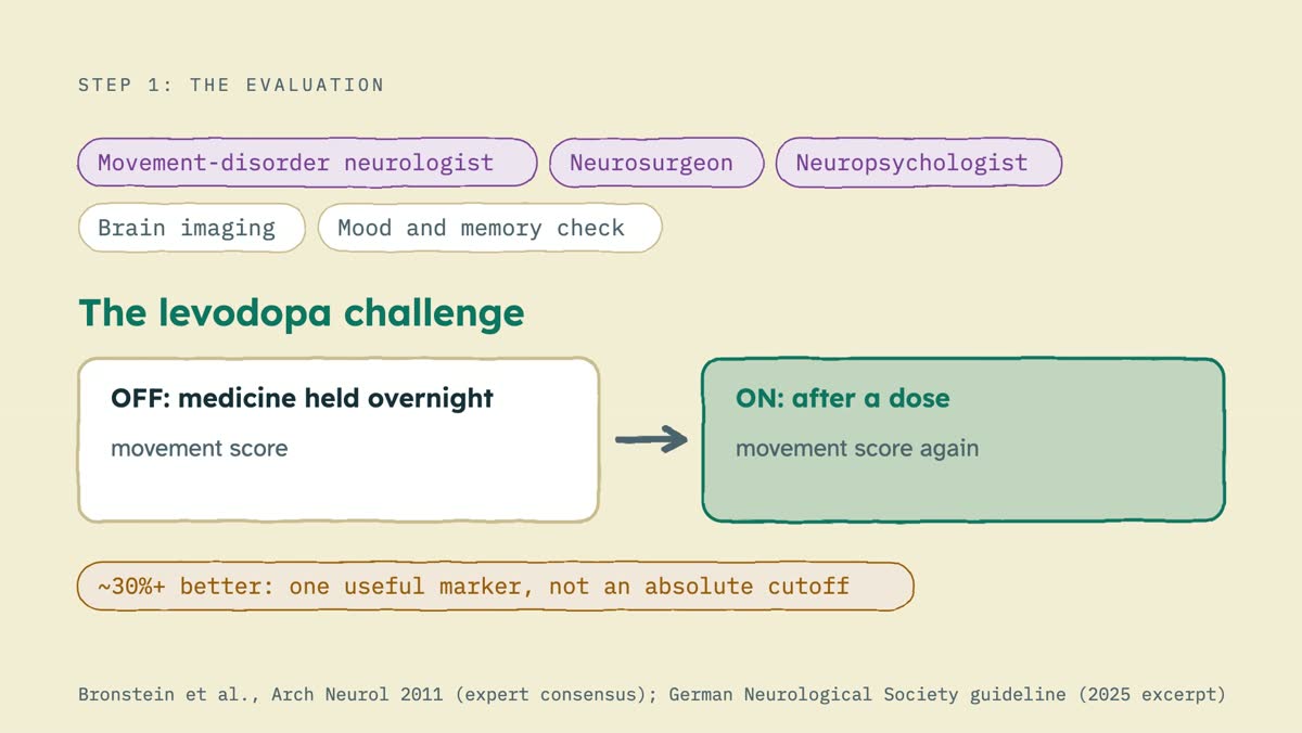 From the video: STEP 1: THE EVALUATION, Movement-disorder neurologist, Neurosurgeon, Neuropsychologist, Brain imaging, Mood and memory check, The levodopa challenge, OFF: medicine held overnight, movement score, ON: after a dose, movement score again, ~30%+ better: one useful marker, not an absolute cutoff, Bronstein e