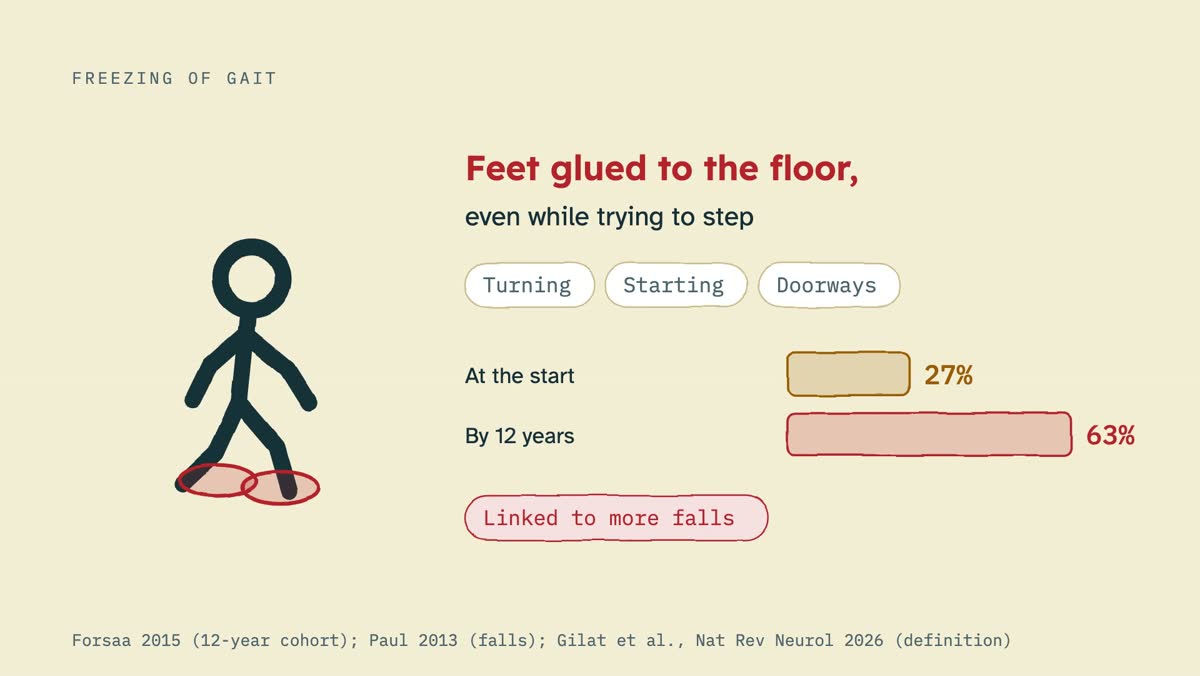 From the video: FREEZING OF GAIT, Feet glued to the floor,, even while trying to step, Turning, Starting, Doorways, At the start, 27%, By 12 years, 63%, Linked to more falls, Forsaa 2015 (12-year cohort); Paul 2013 (falls); Gilat et al., Nat Rev Neurol 2026 (definition)