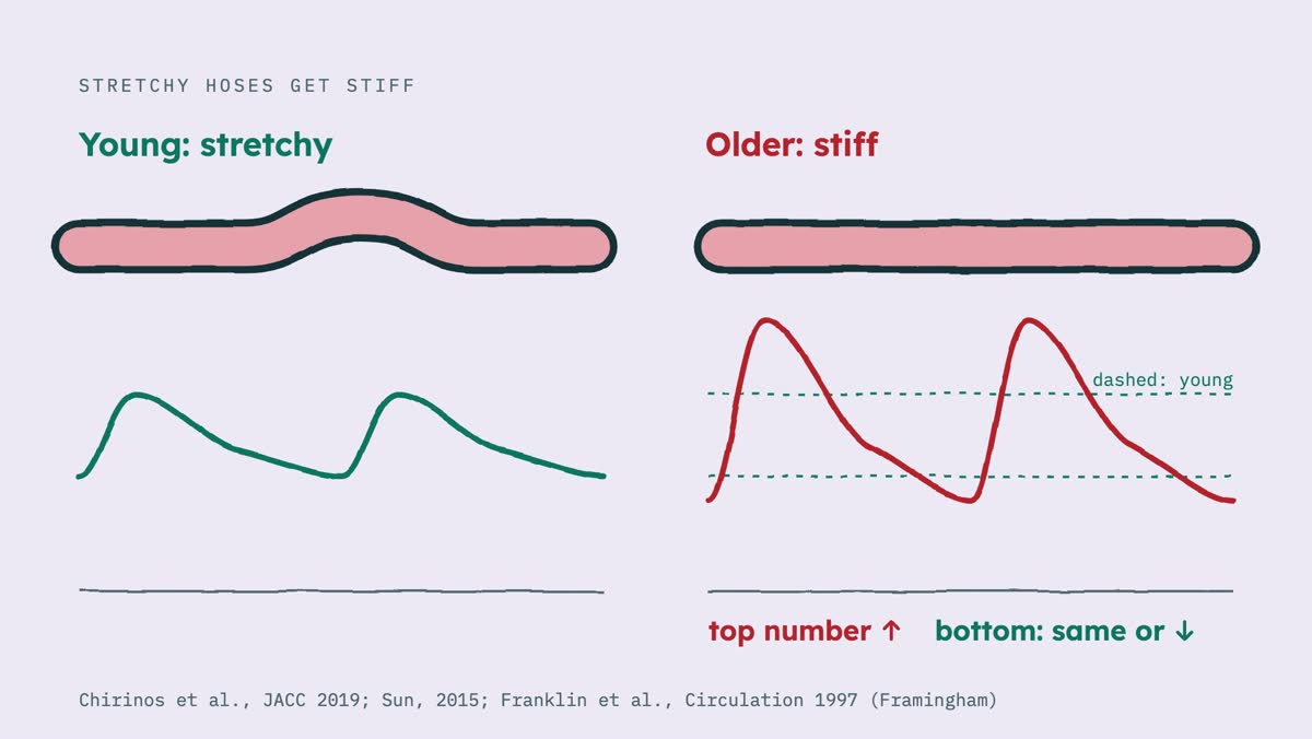 From the video: STRETCHY HOSES GET STIFF, Young: stretchy, Older: stiff, top number ↑, bottom: same or ↓, dashed: young, Chirinos et al., JACC 2019; Sun, 2015; Franklin et al., Circulation 1997 (Framingham)
