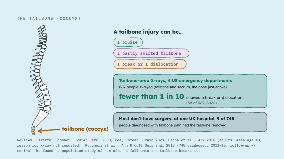 From the video: THE TAILBONE (COCCYX), tailbone (coccyx), A tailbone injury can be…, a bruise, a partly shifted tailbone, a break or a dislocation, Tailbone-area X-rays, 4 US emergency departments, 687 people X-rayed (tailbone and sacrum, the bone just above), fewer than 1 in 10, showed a break or dislocation, (58 of 6